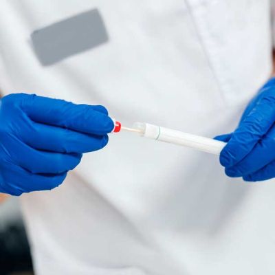 un-test-de-saliva-permite-la-deteccion-precoz-del-cancer-de-boca-y-cuellonotaweb
