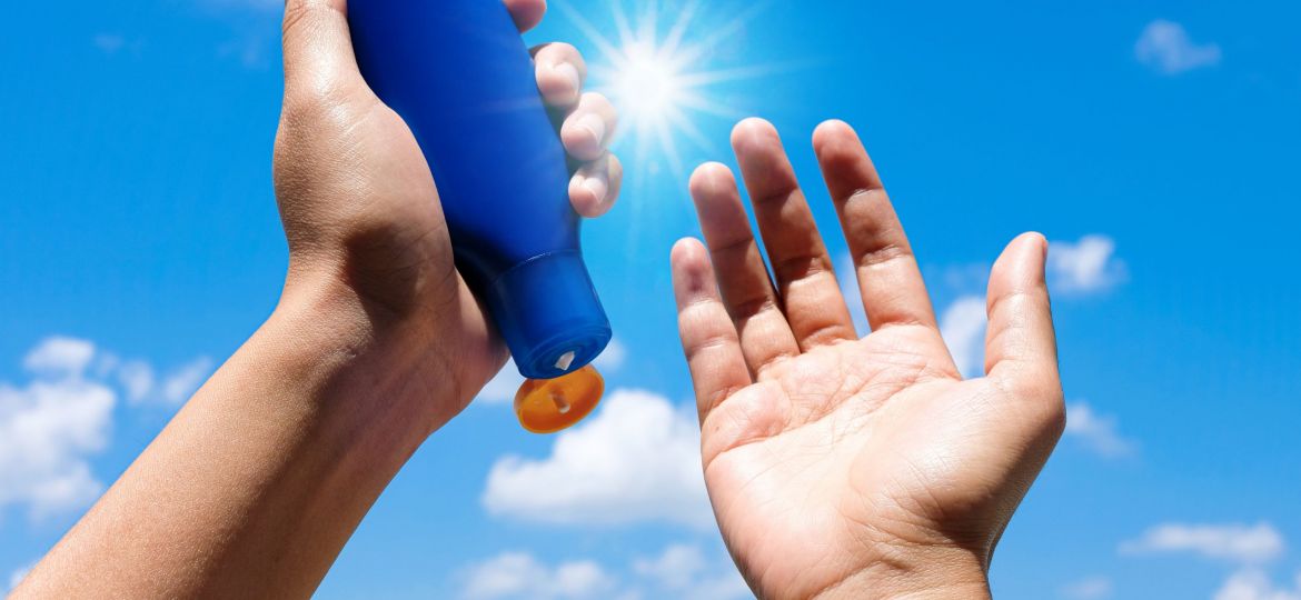 Hand,Of,Female,Holding,Sunscreen.,Very,Sun,Light,Sky,Background.health