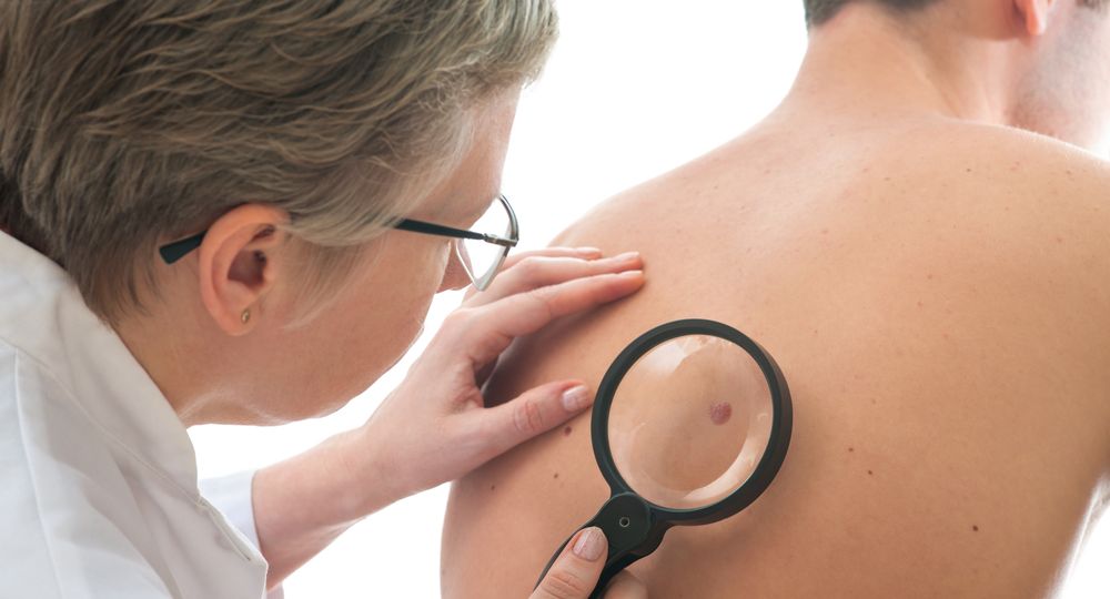 Dermatologist,Examines,A,Mole,Of,Male,Patient