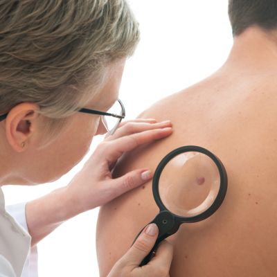 Dermatologist,Examines,A,Mole,Of,Male,Patient